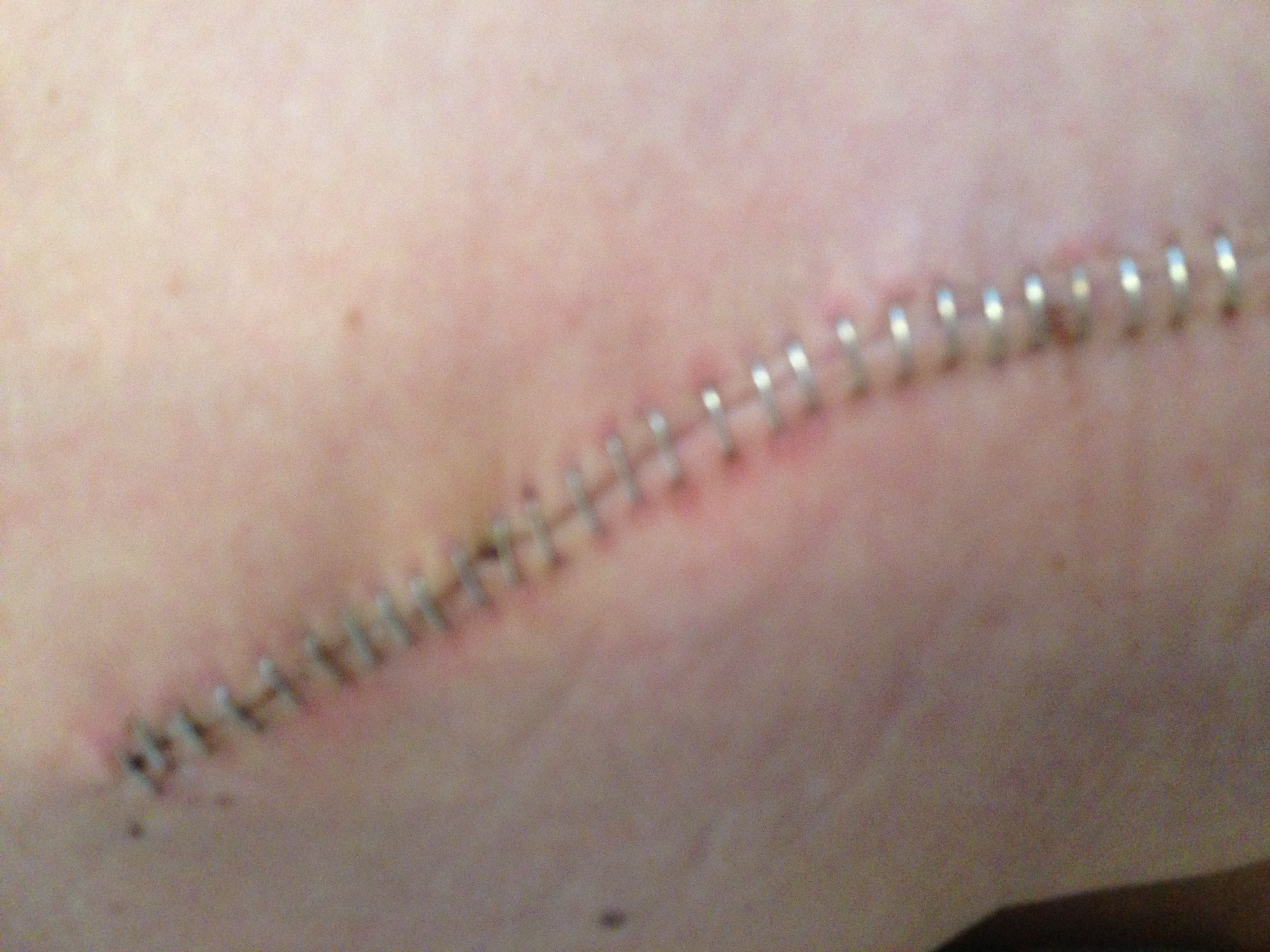 7 veckor senare kom mailet…